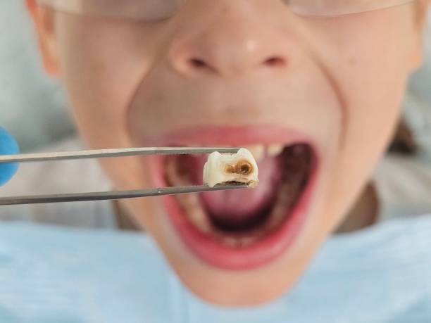 Best Emergency TMJ Treatment in Johnson City, TX